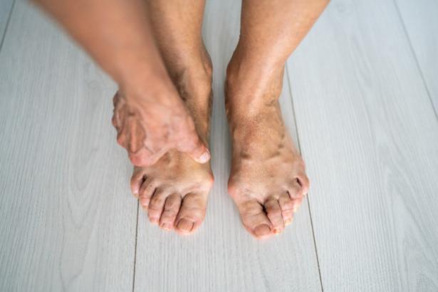 problèmes orthopédiques
